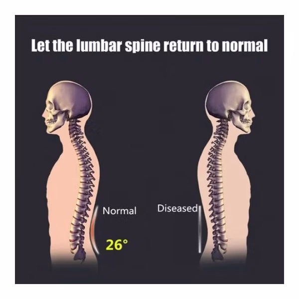 ⁦أداة تدليك للظهر ومنطقة أسفل الظهر⁩ - الصورة ⁦4⁩